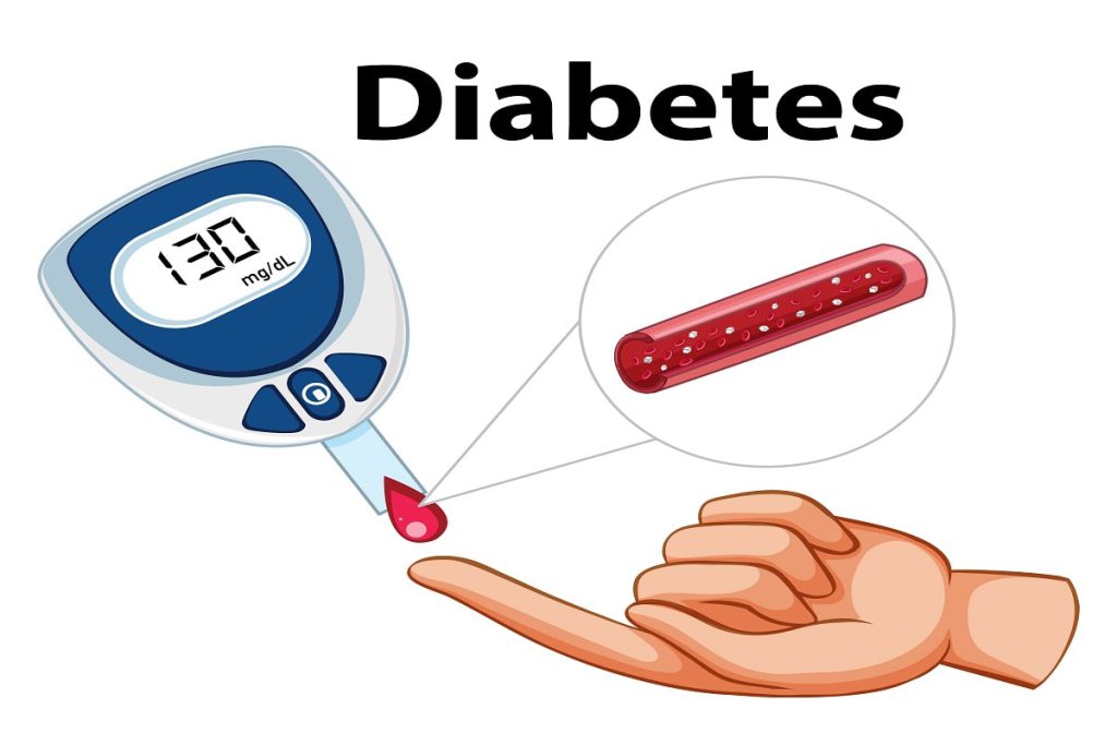 سوکرالوزو دیابت